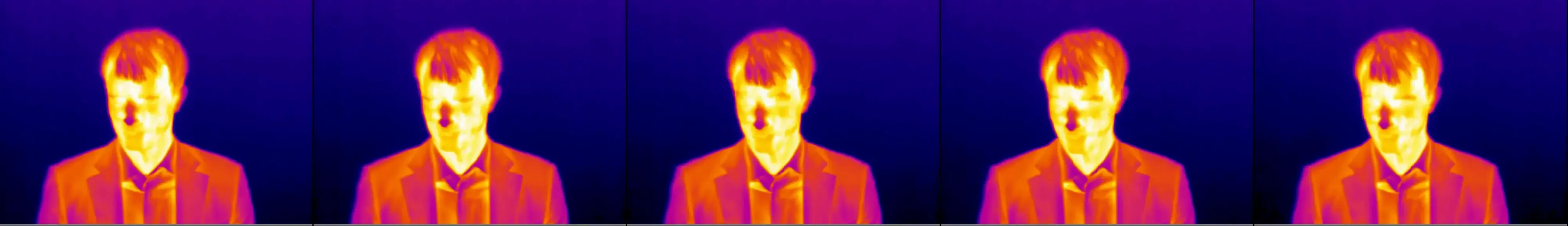 Unnatural Blinking