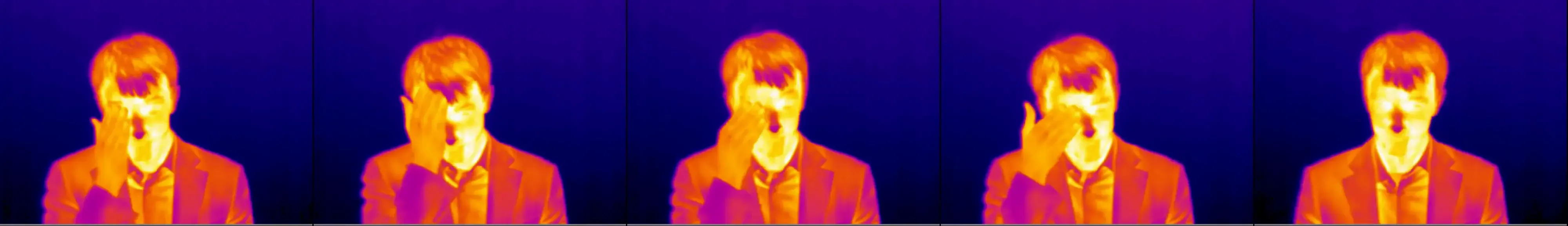 Eye Rubbing